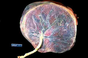 女性分娩直面12个问题