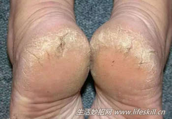 �ź��������Ƥ��ô�죿������ЩСƫ���ɣ�