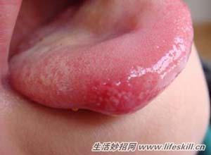 ��ǻ�����ϲ��ã�������Ӧ��